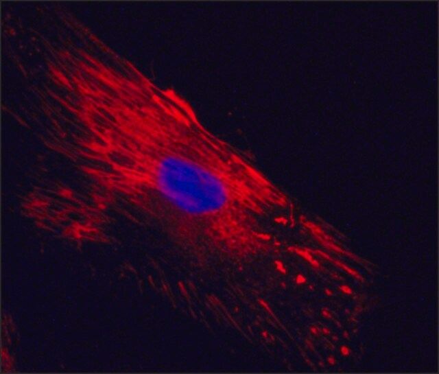 Anti-Cellular Fibronectin antibody, Mouse monoclonal