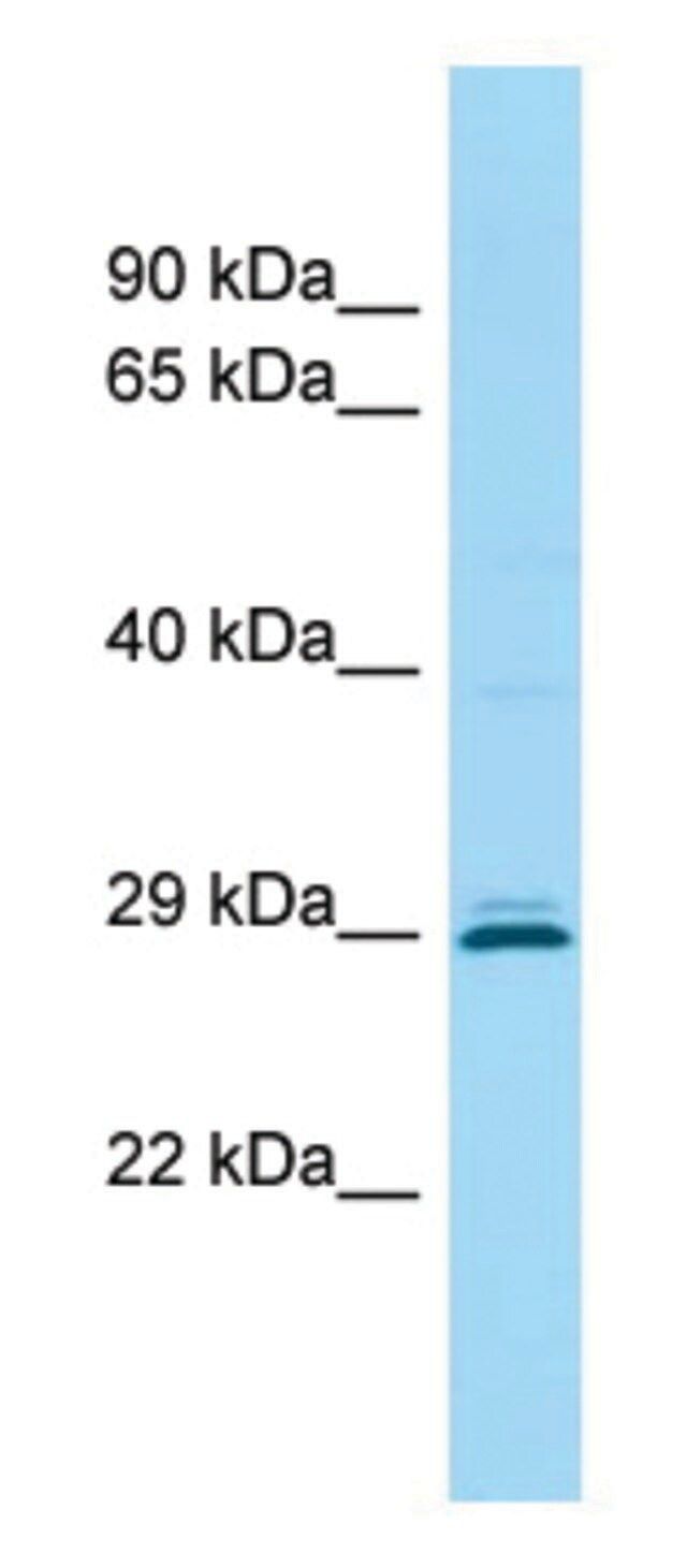 Anti-CEMP1 (C-terminal) antibody produced in rabbit