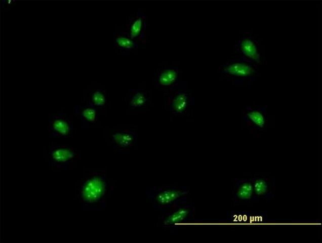 Anti-CEBPZ antibody produced in mouse