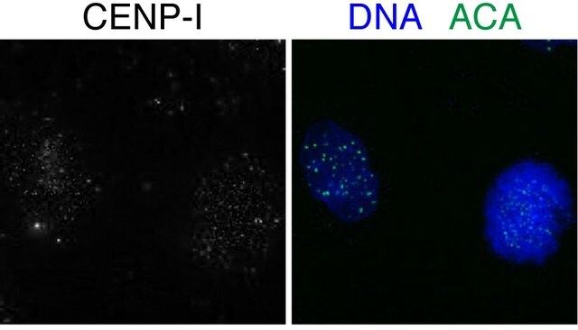 Anti-CENPI antibody produced in rabbit