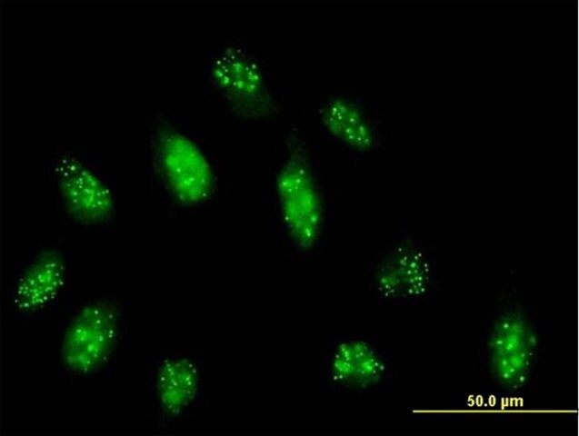 Anti-CENPB antibody produced in mouse