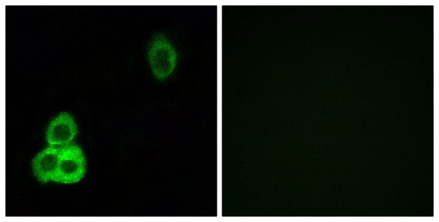 Anti-CELSR1 antibody produced in rabbit