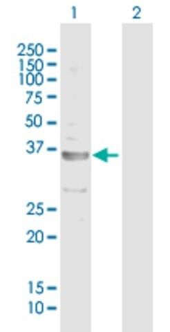 Anti-CECR1 antibody produced in mouse