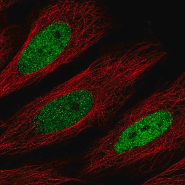 Anti-CEBPD antibody produced in rabbit