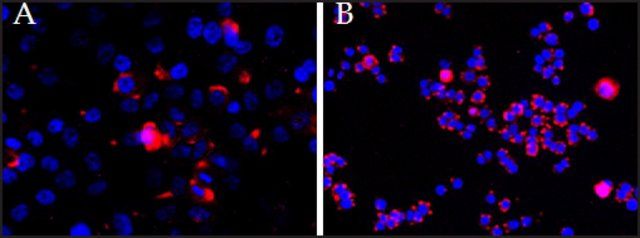 Anti-CEP290 antibody produced in goat