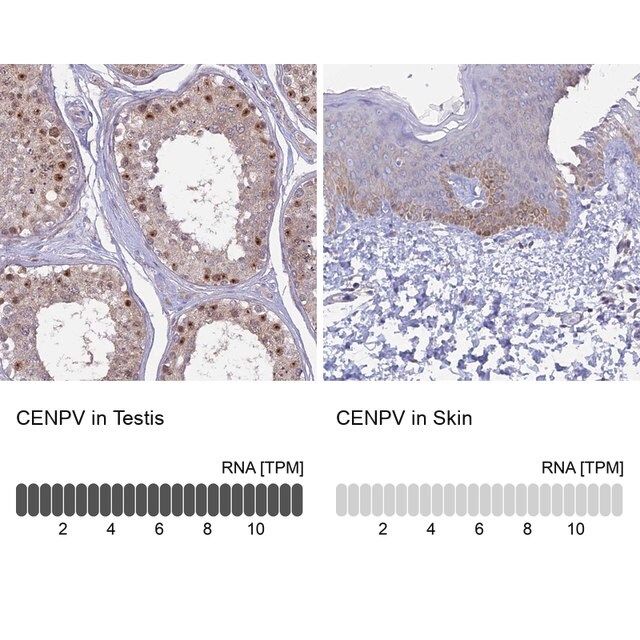 Anti-CENPV antibody produced in rabbit