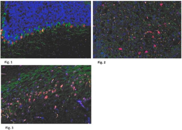 Anti-CELSR1 Antibody