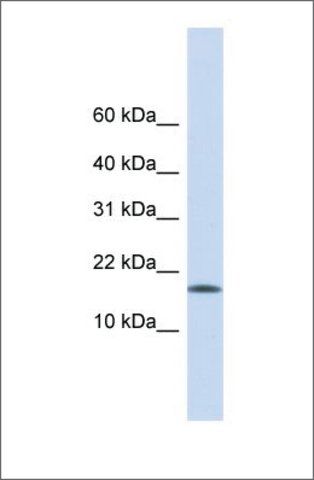 Anti-CENPA antibody produced in rabbit