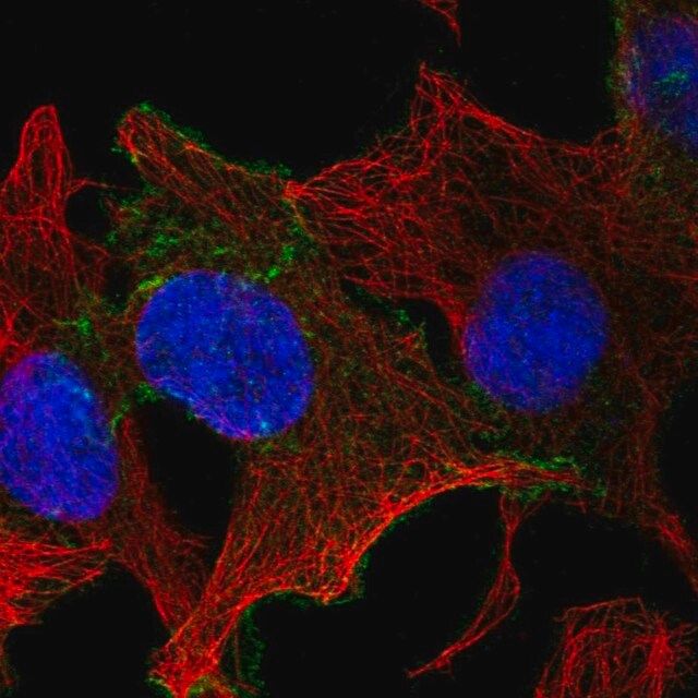 Anti-CELSR1 antibody produced in rabbit