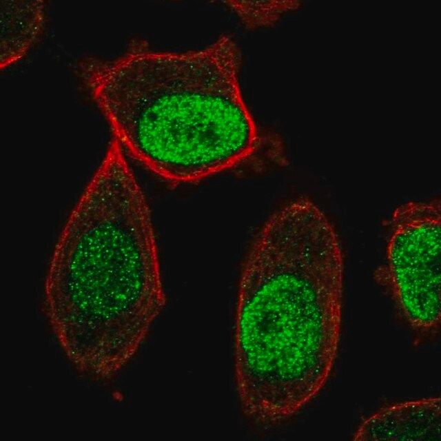 Anti-CENPA antibody produced in rabbit