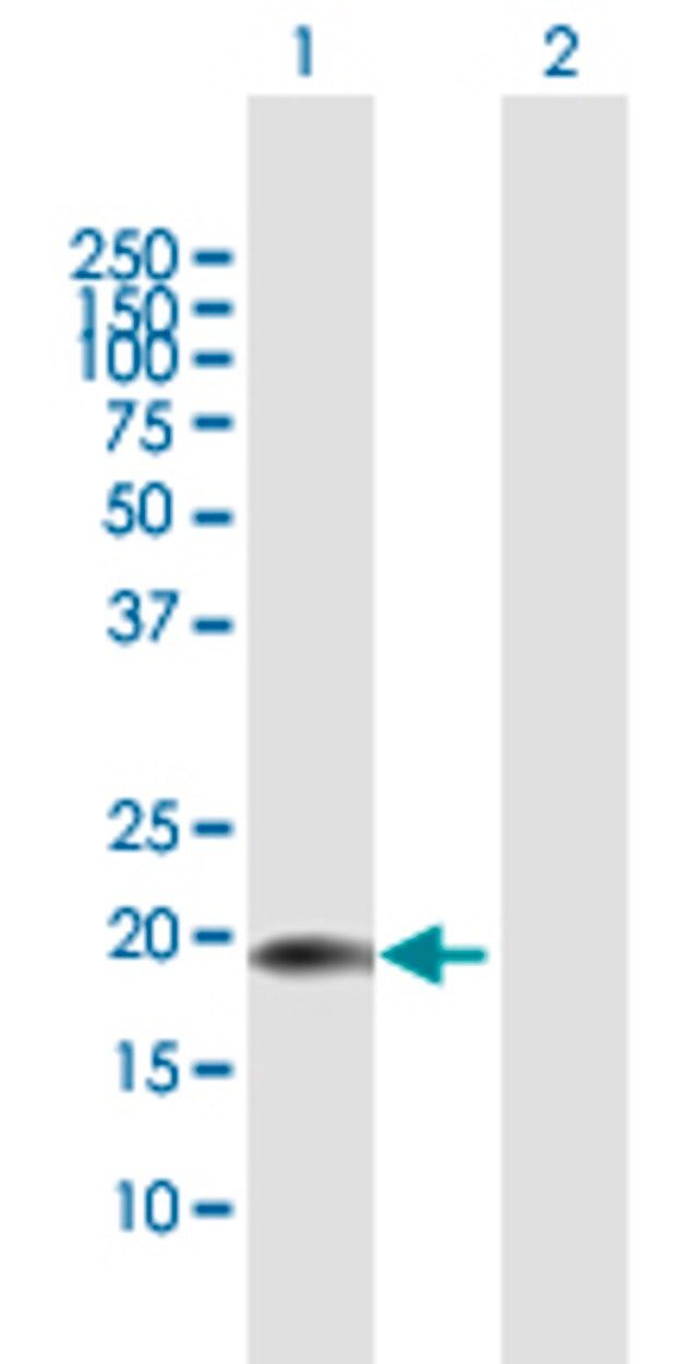 Anti-CENPM antibody produced in mouse