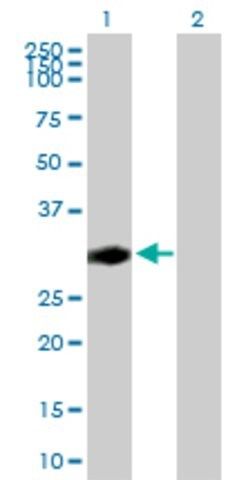 Anti-CENPP antibody produced in mouse