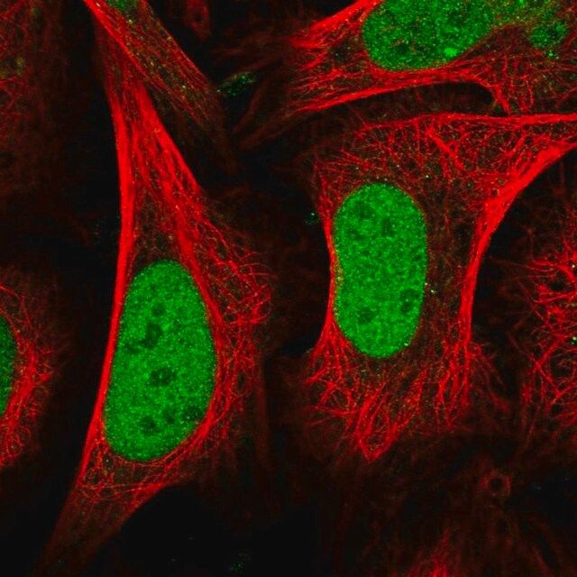 Anti-CENPQ antibody produced in rabbit