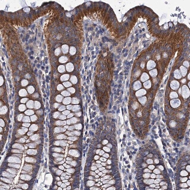 Anti-CEP295 antibody produced in rabbit