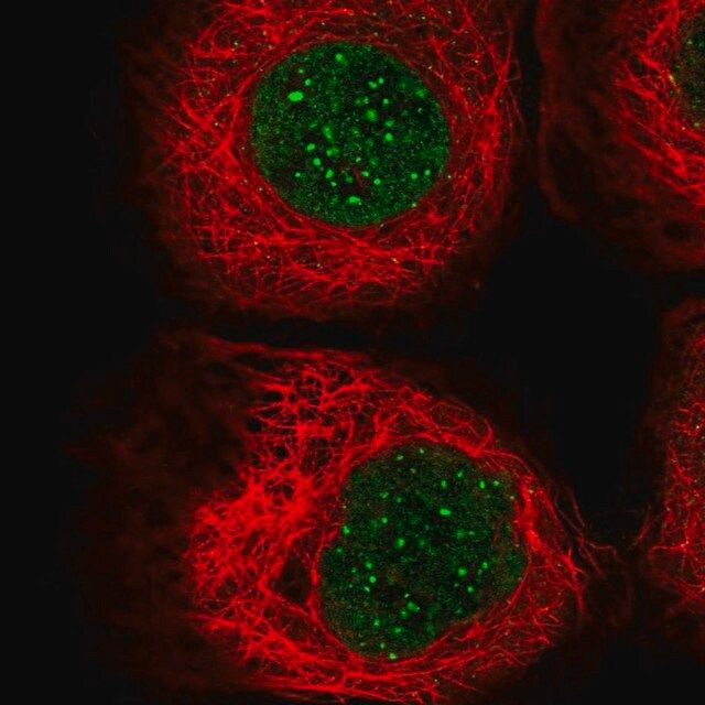 Anti-CENPB antibody produced in rabbit