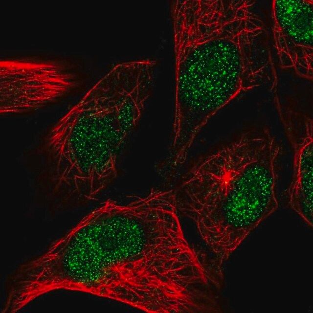 Anti-CENPW antibody produced in rabbit