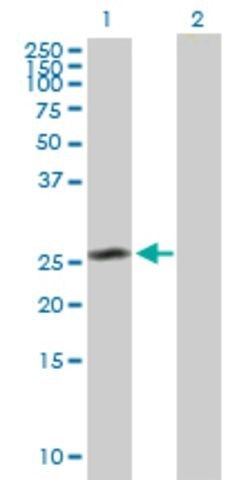 Anti-CEP27 antibody produced in mouse