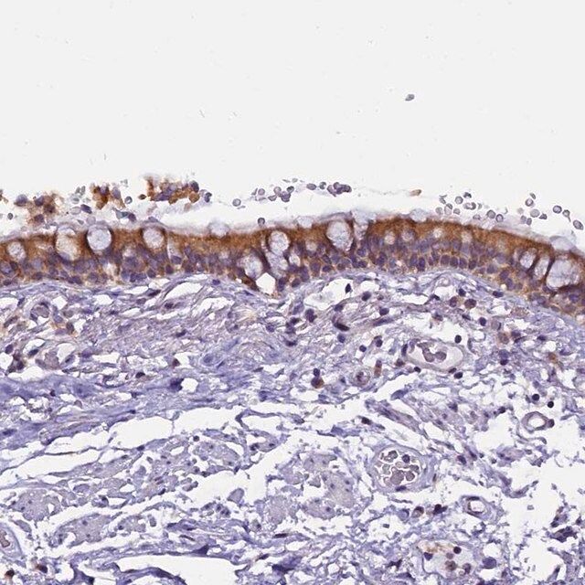 Anti-CEP170 antibody produced in rabbit