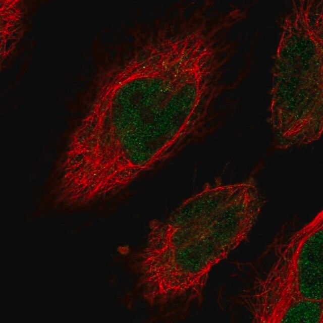 Anti-CENPN antibody produced in rabbit