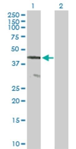 Anti-CENTG2 antibody produced in mouse