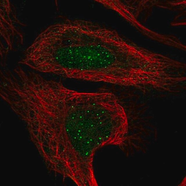 Anti-CENPT antibody produced in rabbit