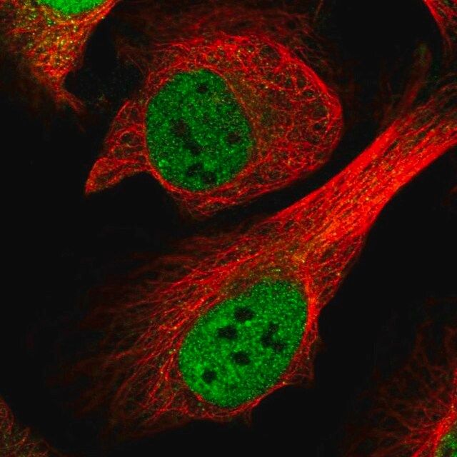 Anti-CENPF antibody produced in rabbit