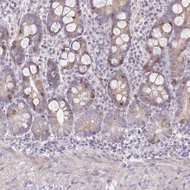 Anti-CENPH antibody produced in rabbit