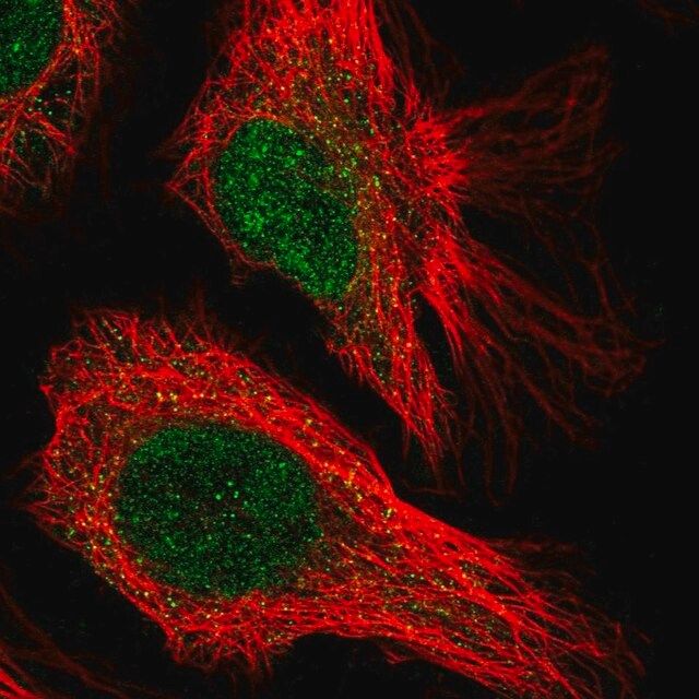 Anti-CENPQ antibody produced in rabbit