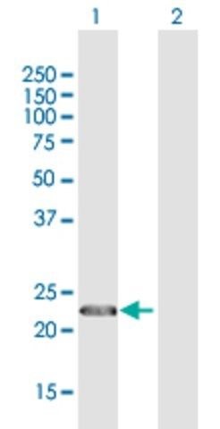 Anti-CENPN antibody produced in rabbit