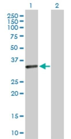 Anti-CENPP antibody produced in rabbit