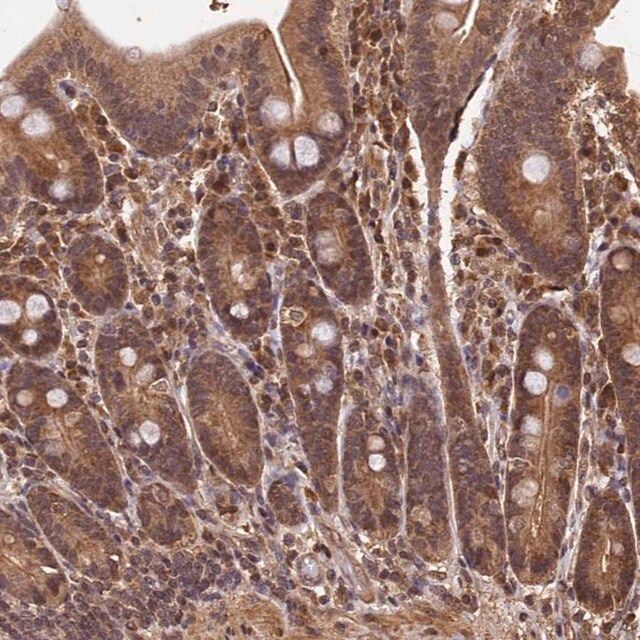 Anti-CEP57L1 antibody produced in rabbit