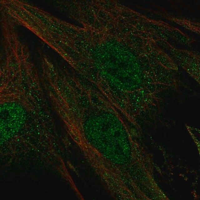 Anti-CERKL antibody produced in rabbit