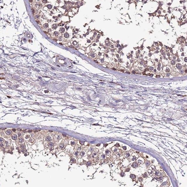 Anti-CEP55 antibody produced in rabbit