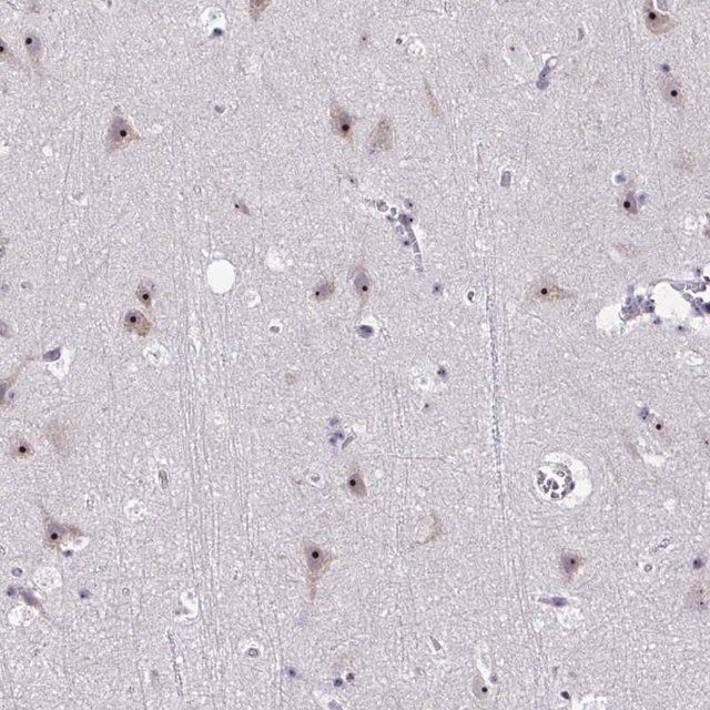 Anti-CEP72 antibody produced in rabbit