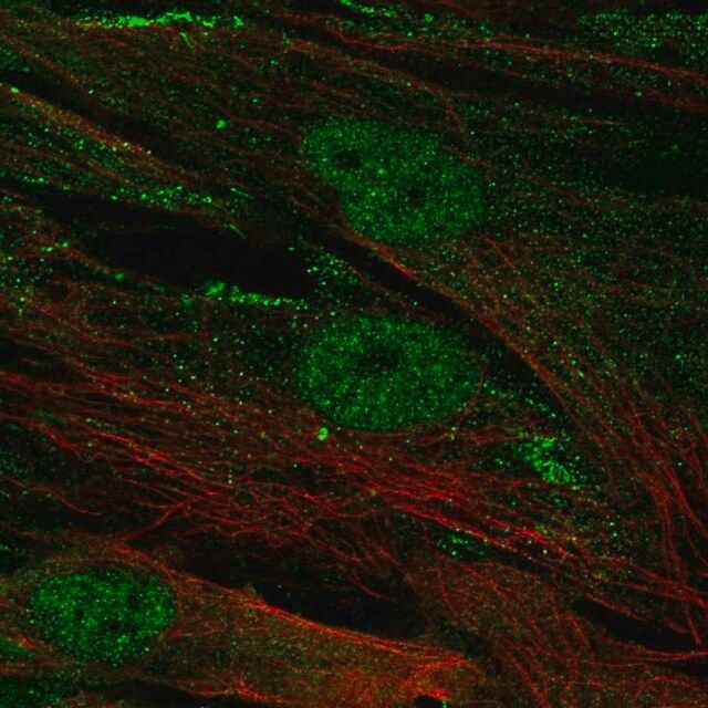 Anti-CENPJ antibody produced in rabbit