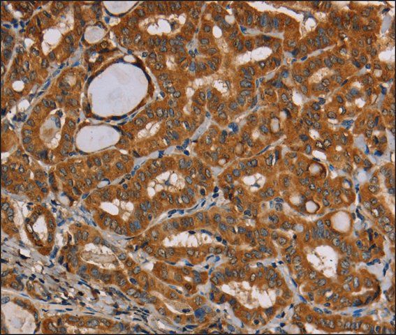 Anti-CENPU antibody produced in rabbit