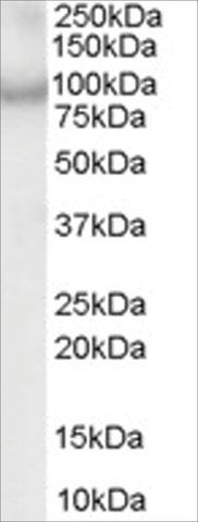 Anti-CENTB2/ACAP2 antibody produced in goat