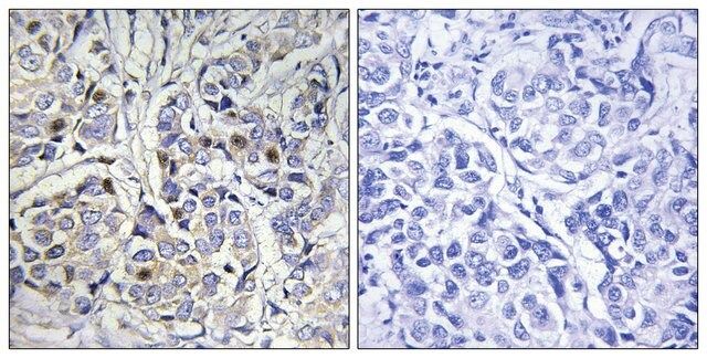 Anti-Centromeric Protein A antibody produced in rabbit