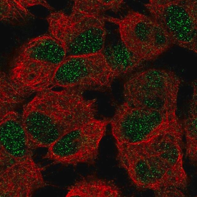 Anti-CERS6 antibody produced in rabbit