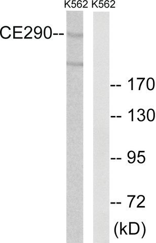 Anti-CEP290 antibody produced in rabbit