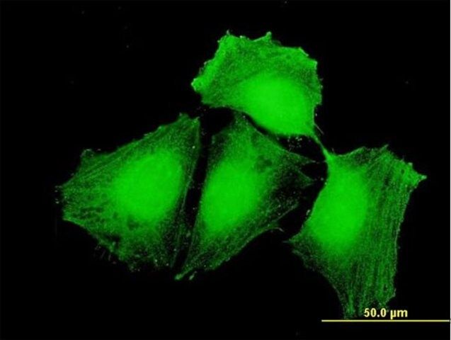 Anti-CEP57 antibody produced in mouse