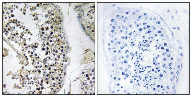 Anti-CEP170 antibody produced in rabbit