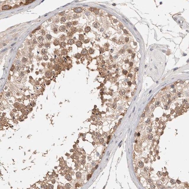 Anti-CERS3 antibody produced in rabbit