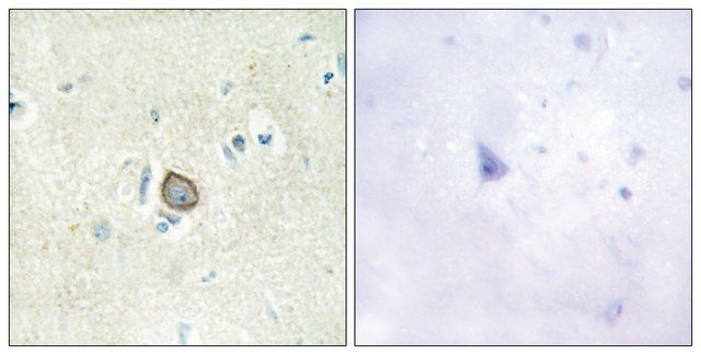 Anti-CELSR3 antibody produced in rabbit