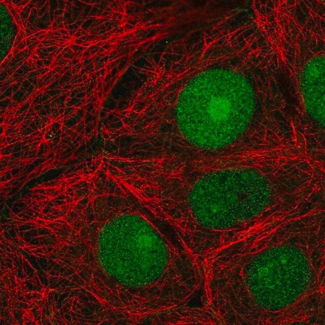 Anti-CERCAM antibody produced in rabbit