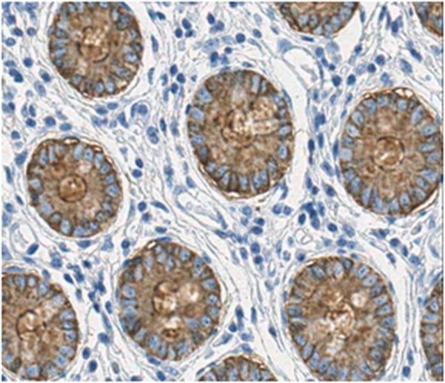 Anti-CEP Antibody, clone Das-1 (7E12H12)