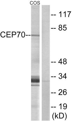 Anti-CEP70 antibody produced in rabbit