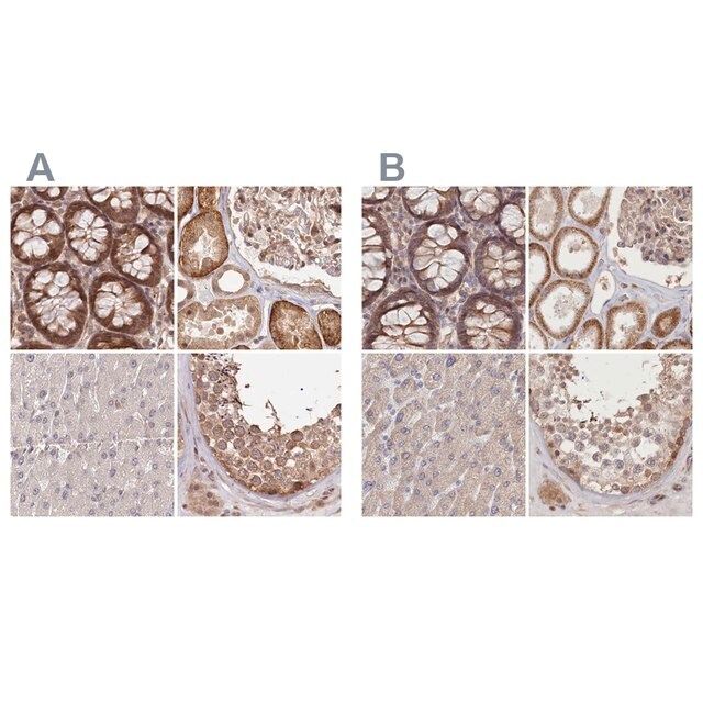 Anti-CEP70 antibody produced in rabbit