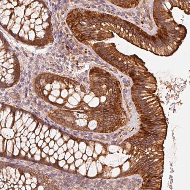 Anti-CEP95 antibody produced in rabbit