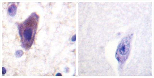 Anti-CD71 antibody produced in rabbit